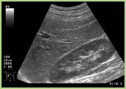 Sonographie: Leber und rechte Niere