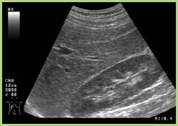 Sono Leber Sono Leber